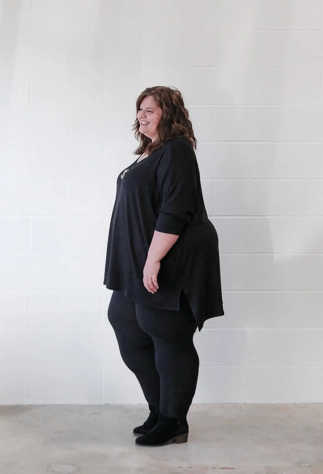 Angel Anderson living with lipedema before life changing lipedema reduction surgery.