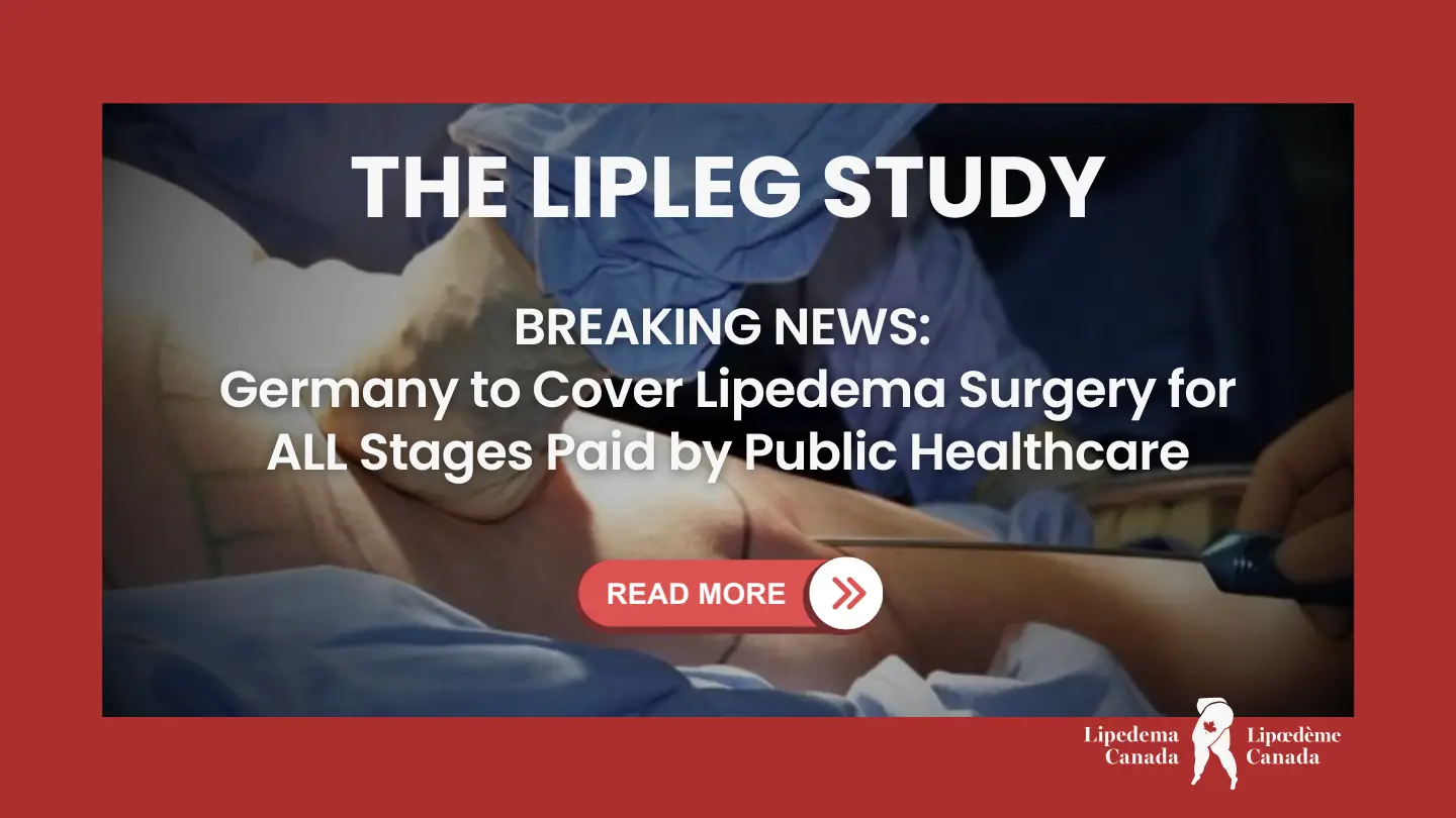 Germany approved lipedema surgery for all stages